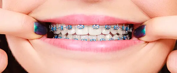 Orthodontics